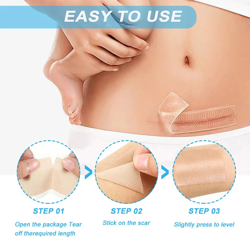 Reusable Silicone Gel Tape for Effective Scar Reduction and Skin Repair