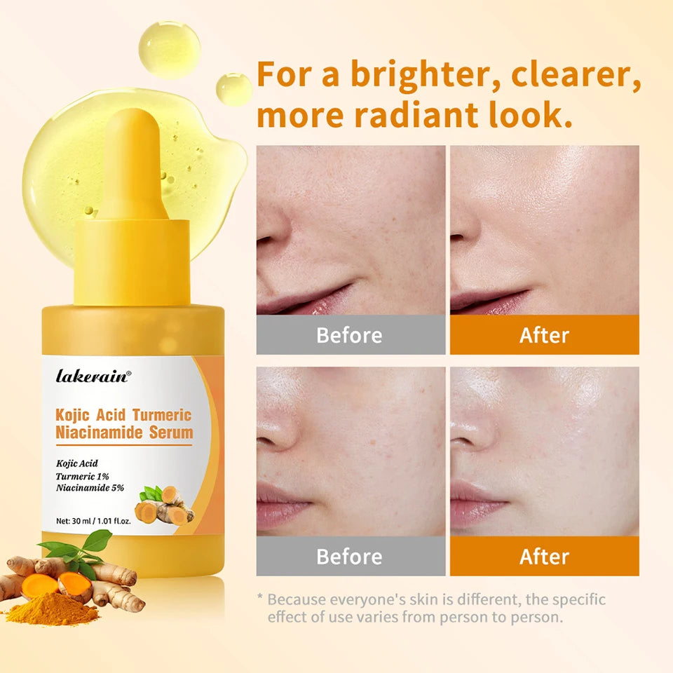 Brightening Kojic Acid and Turmeric Face Serum for Even Skin Tone