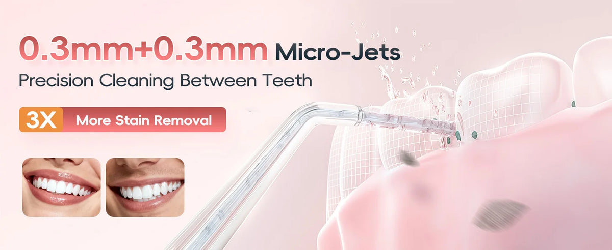 Rechargeable Portable Oral Irrigator Water Flosser for Deep Teeth Cleaning