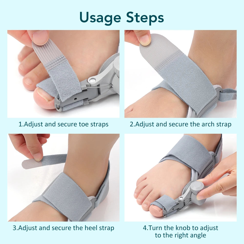 Adjustable Orthopedic Bunion Corrector for Painless Toe Alignment
