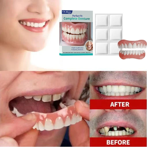 Comfort Fit Cosmetic Silicone Teeth Veneers for Natural Smile Enhancement - 3