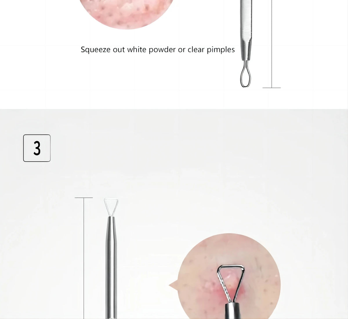 Professional Stainless Steel Blackhead and Pimple Extractor Tool Kit