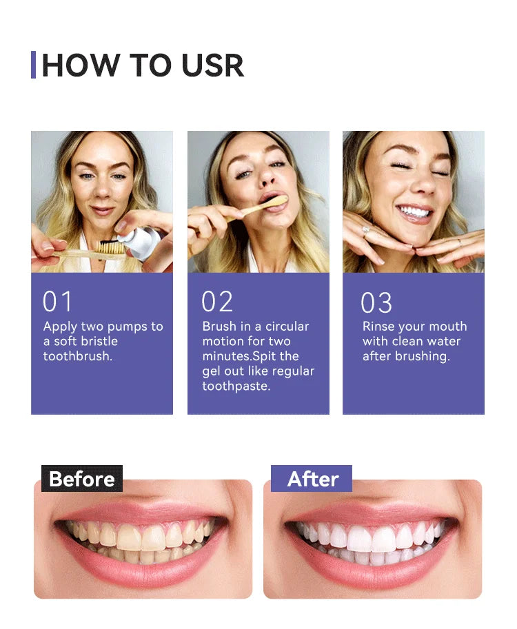 Portable Electric Water Flosser and Teeth Whitening Kit for Oral Care - 17
