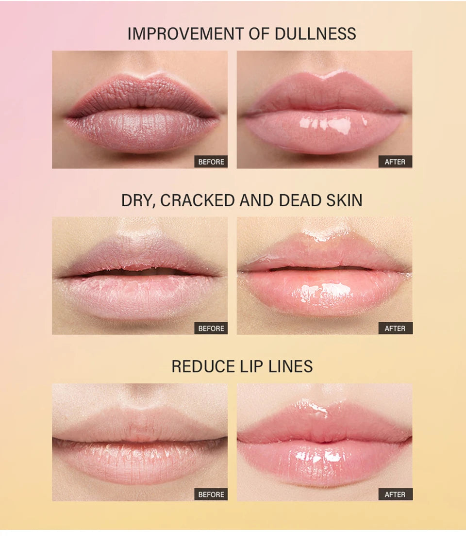 Peptide Moisturizing Lip Treatment Gel for Soft and Nourished Lips - 11