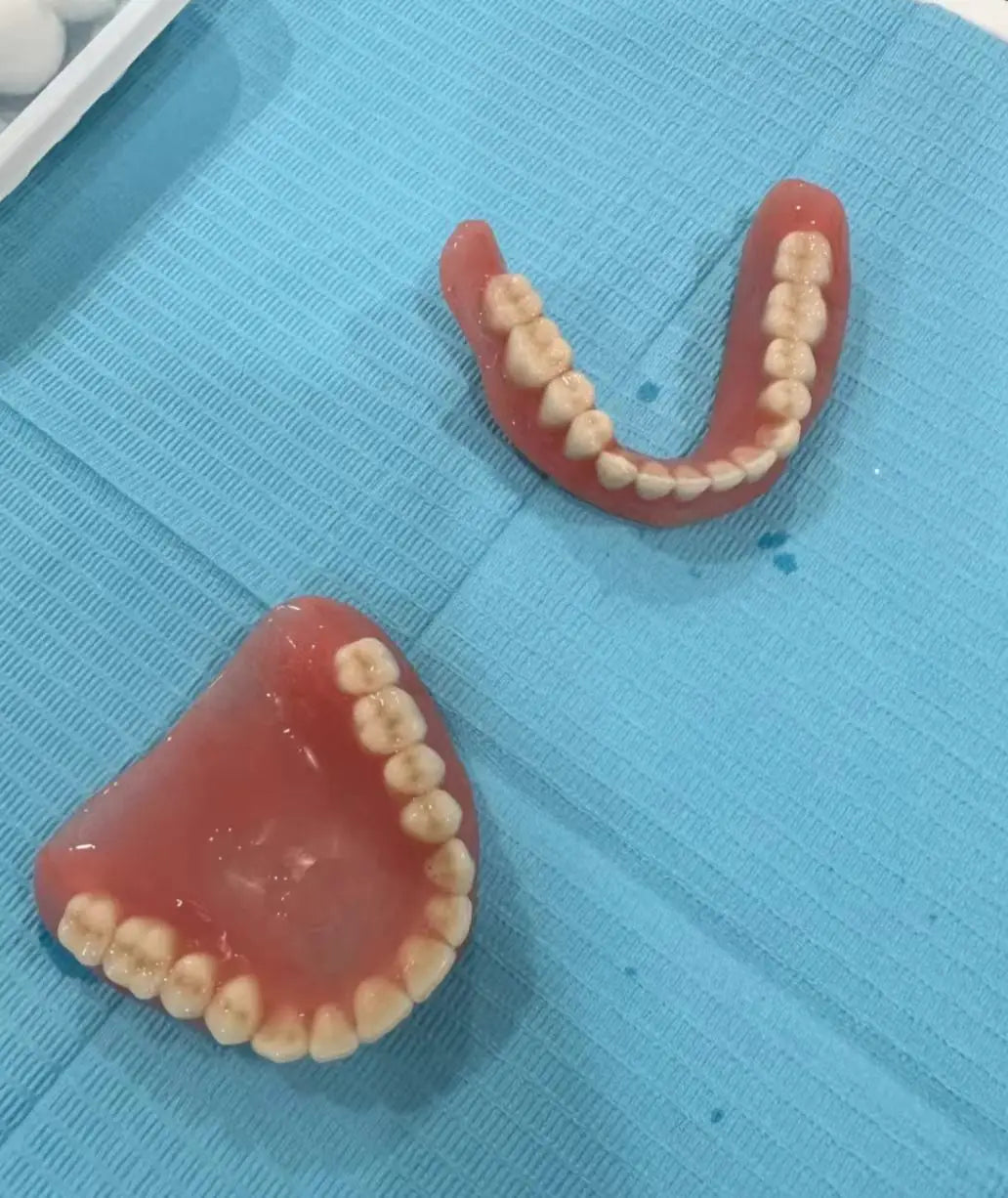 Temporary Moldable Silicone Dentures for Instant Smile Restoration - 2