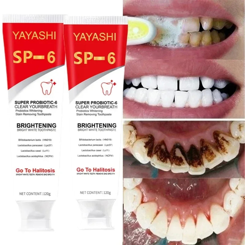 Probiotic Teeth Whitening Toothpaste for Stain Removal and Fresh Breath