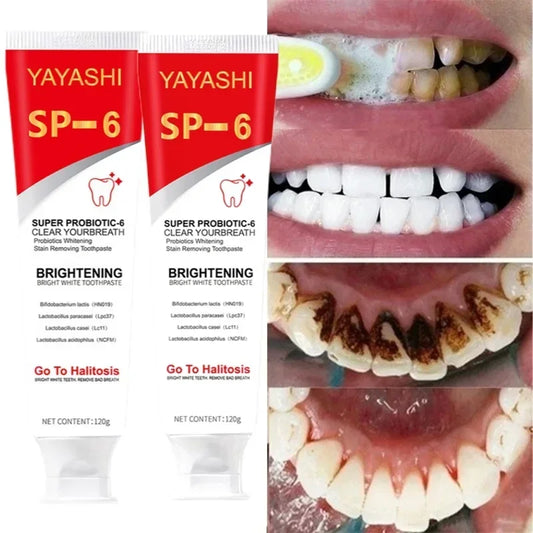 Probiotic Teeth Whitening Toothpaste for Stain Removal and Fresh Breath