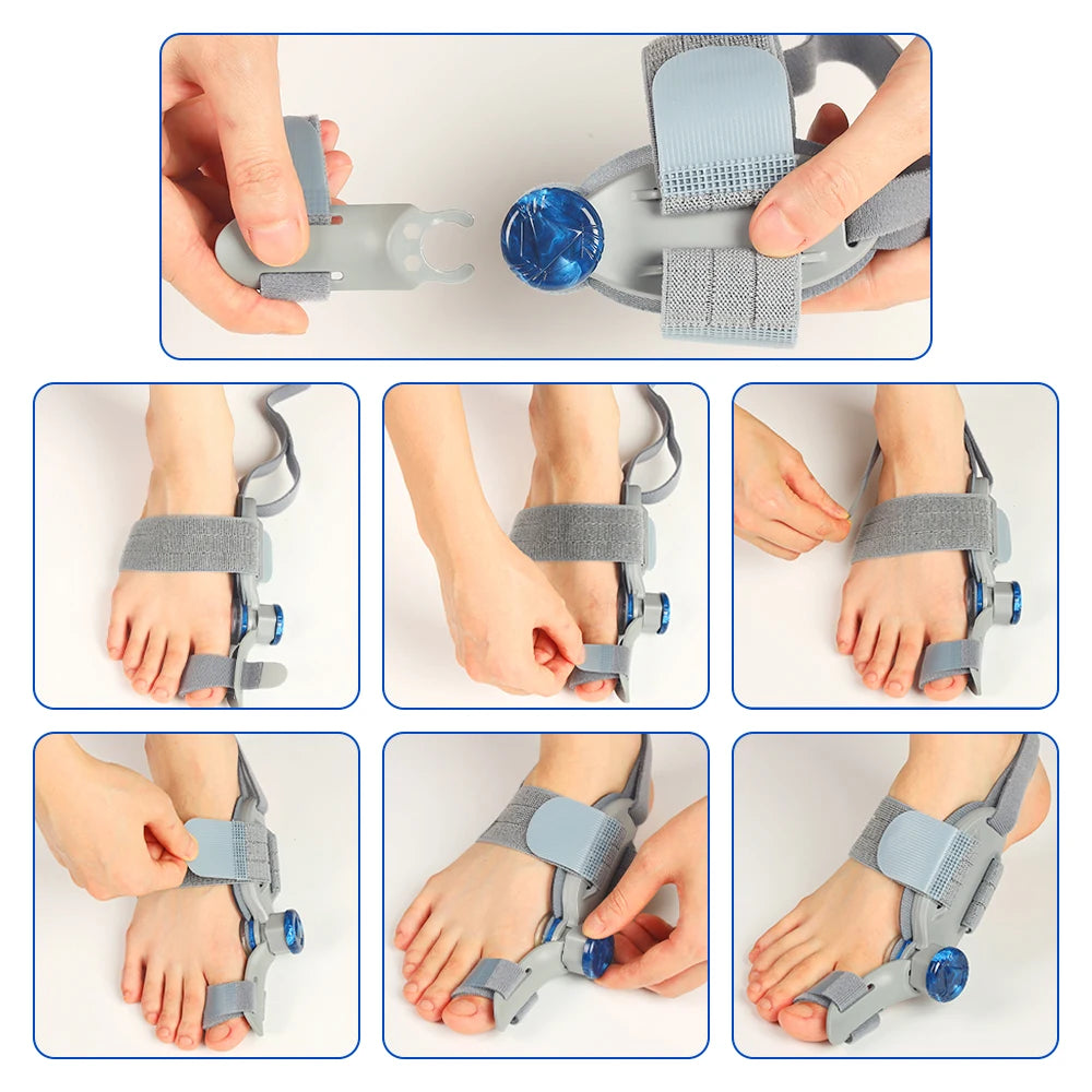 Adjustable Bunion Corrector with Knob Dial for Pain Relief and Alignment - 17