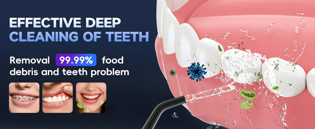Cordless Water Flosser for Teeth with 4 Pressure Settings and 4 Jet Tips