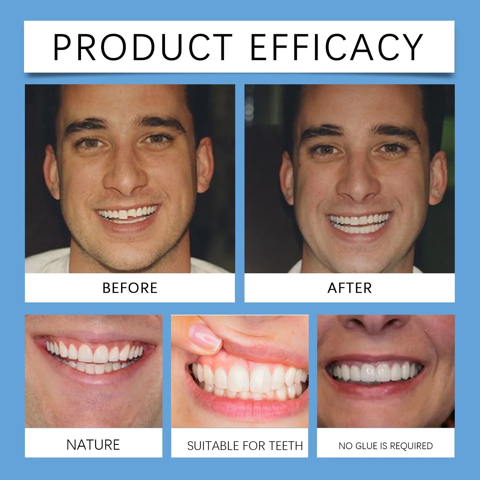 Adjustable Snap-On Silicone Dentures for Instant Smile Repair - 18