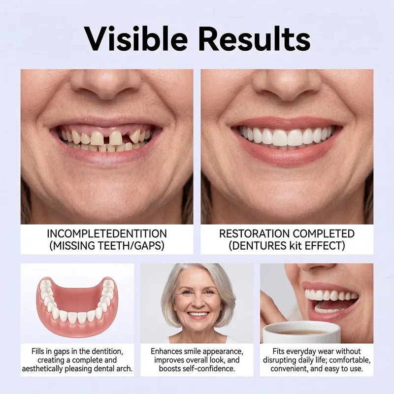 Comfortable Silicone Full Set Dentures for Instant Smile Enhancement