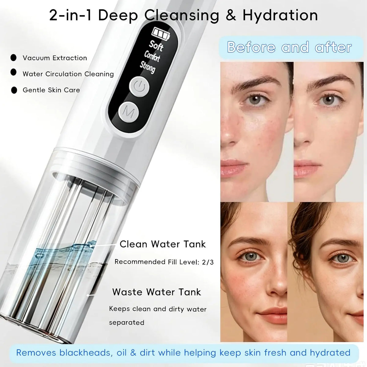 Electric Pore Vacuum and Blackhead Remover for Deep Facial Cleansing