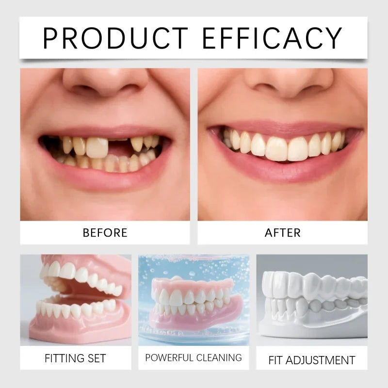 Temporary Silicone Dentures for Missing or Broken Teeth Confidence Smile - 2