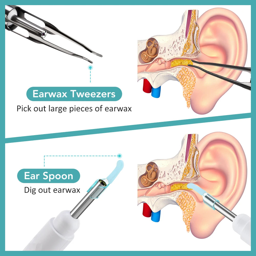 Smart Visual Ear Wax Removal Tool with HD Camera and Tweezers - 9