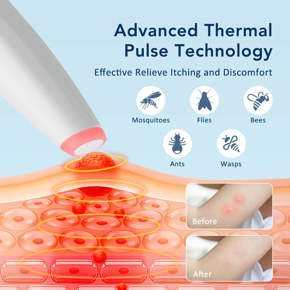 Electronic Insect Bite Relief Pen for Instant Itch and Inflammation Stop