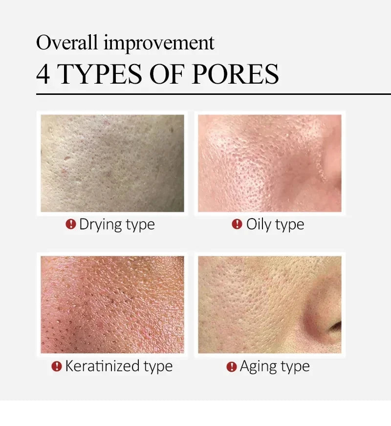 Salicylic Acid Pore Refining Cream for Smooth and Clear Skin