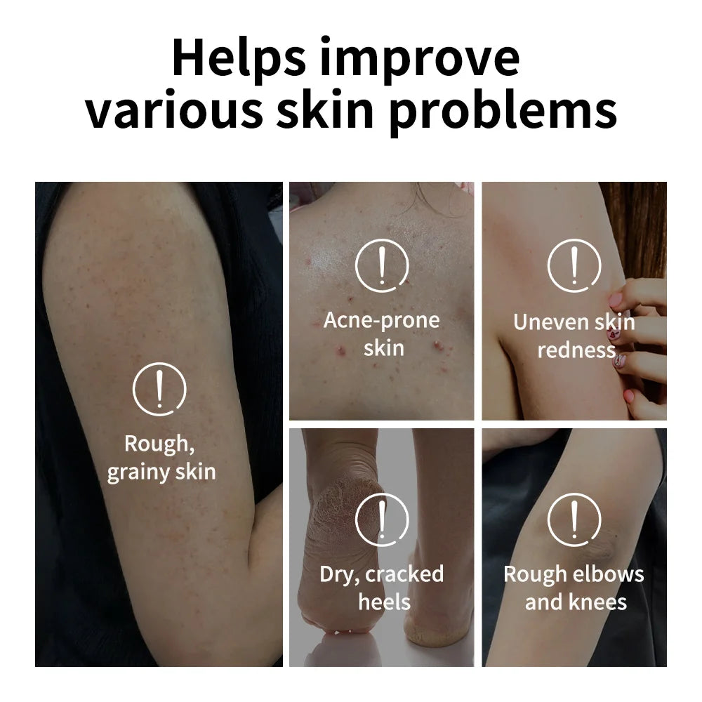 Glycolic Acid Exfoliating Body Stick for Smooth and Radiant Skin - 5