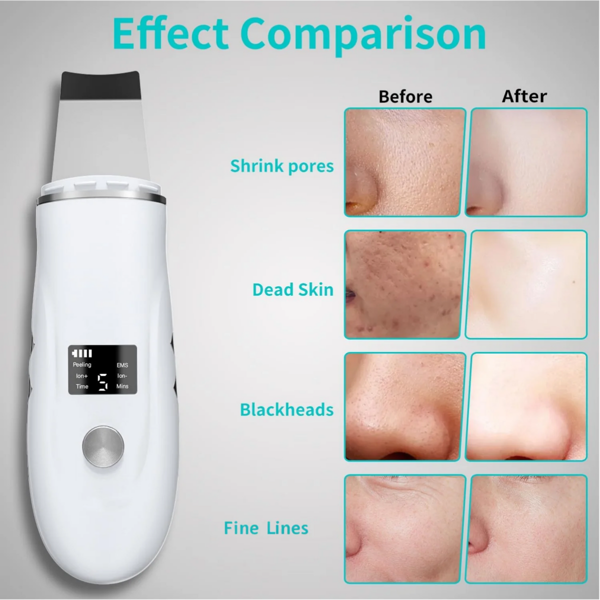 Ultrasonic Facial Skin Scrubber and Pore Cleansing Spatula Device