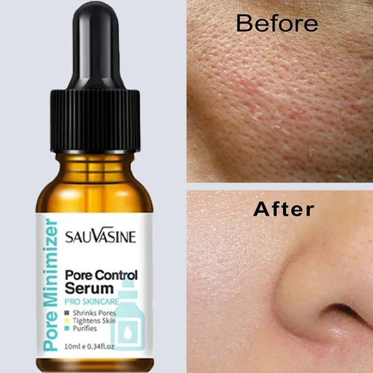 Pore Minimizing Facial Serum for Skin Tightening and Smooth Complexion