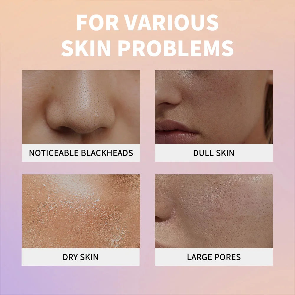 Exfoliating Rice Essence Serum for Deep Pore Cleansing and Skin Brightening - 6