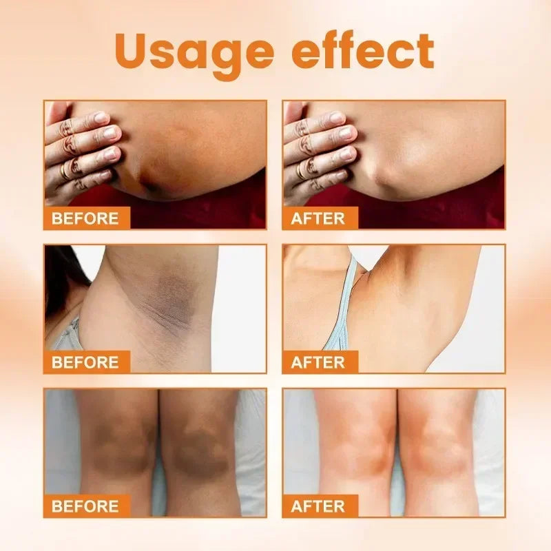 Vitamin C Brightening Cream for Dark Spots Underarms Elbows and Knees