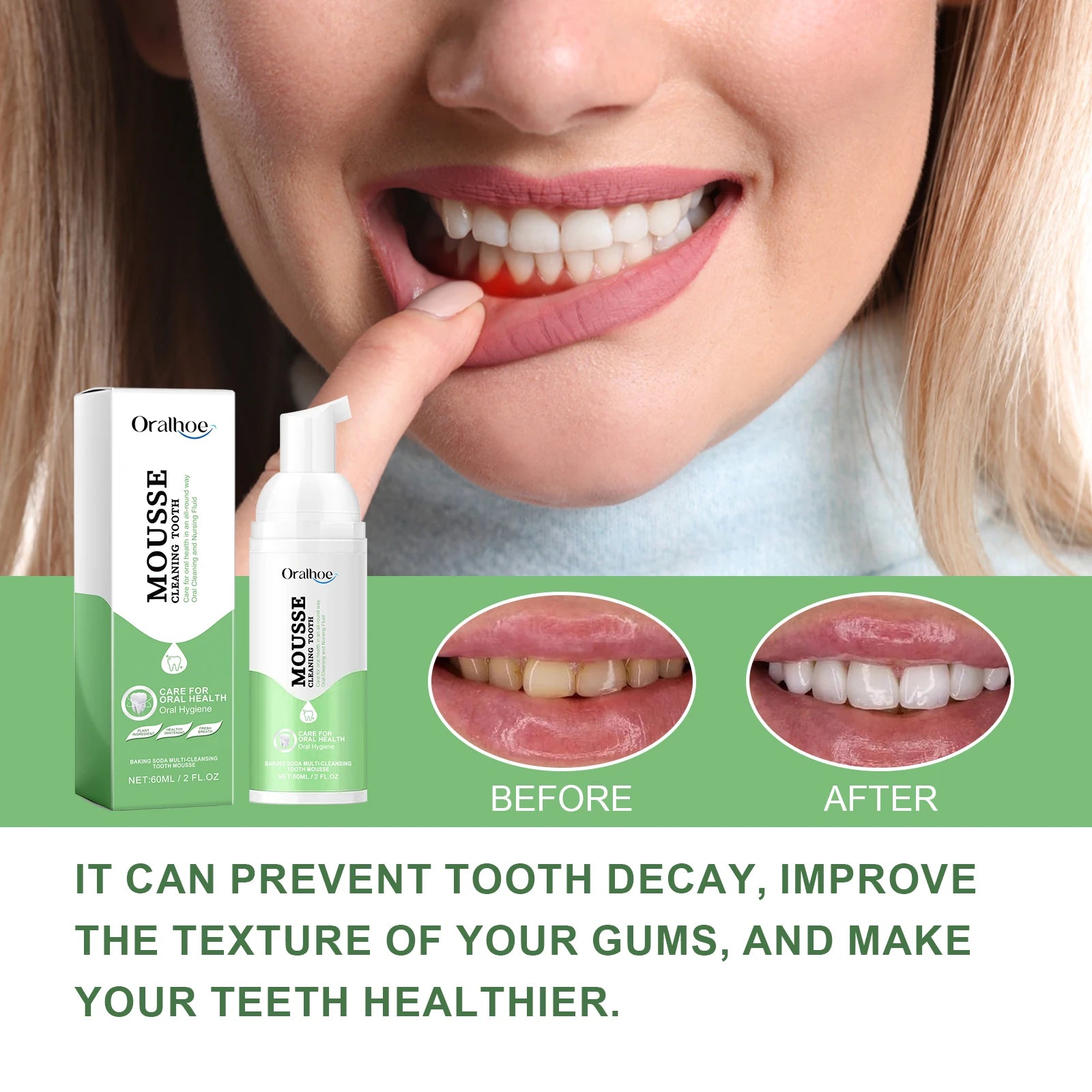 Foaming Teeth Whitening Mousse for Stain Removal and Fresh Breath - 8