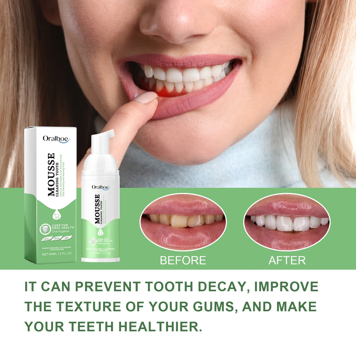 Foaming Teeth Whitening Mousse for Stain Removal and Fresh Breath