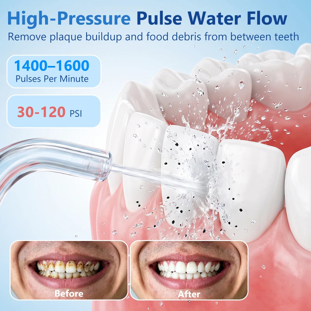 Portable Rechargeable Water Flosser for Deep Teeth and Gum Cleaning - 9