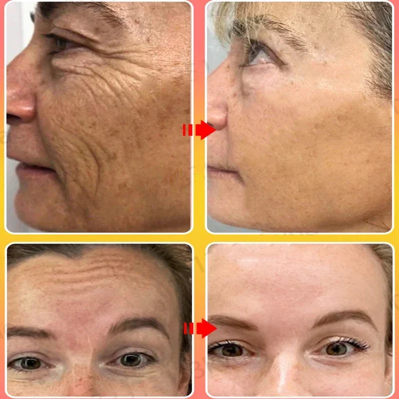 Instant Anti-Wrinkle Face Cream for Firming and Youthful Skin