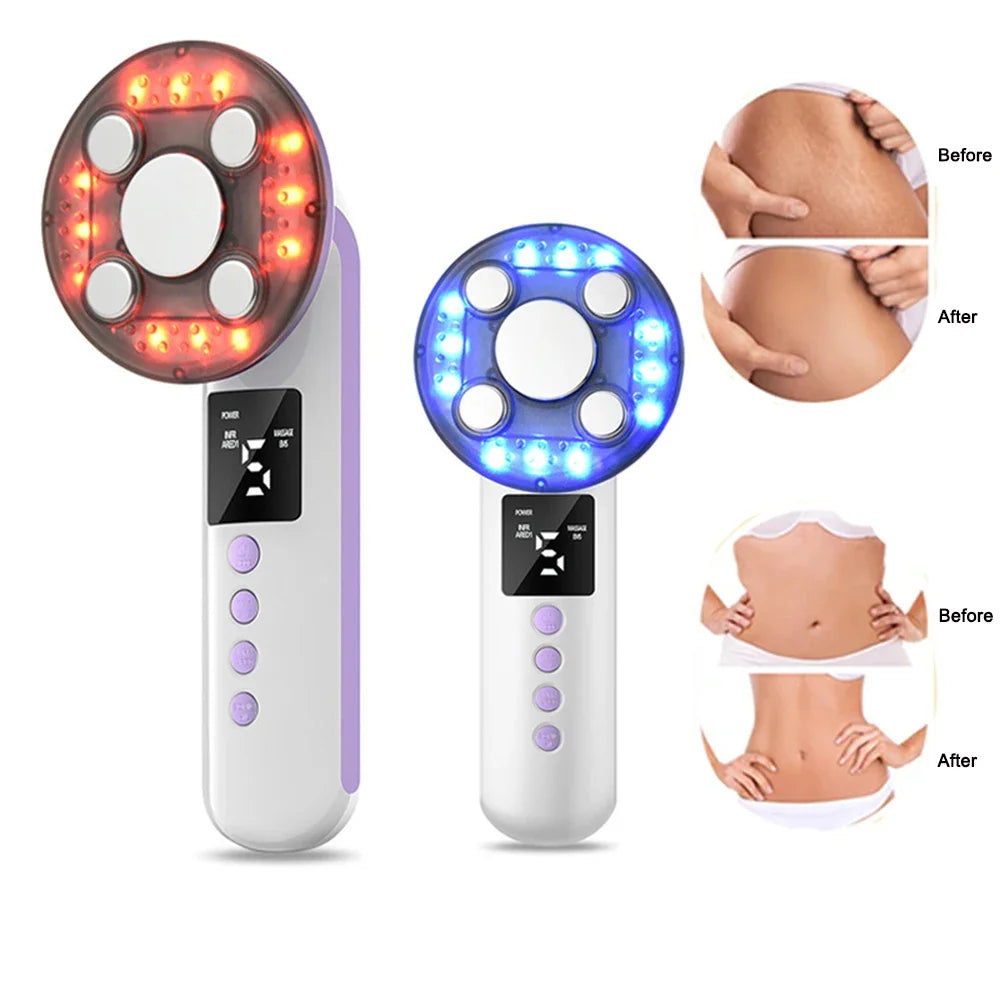 3-in-1 Ultrasonic Body Slimming and Cellulite Reduction Massage Device - 1