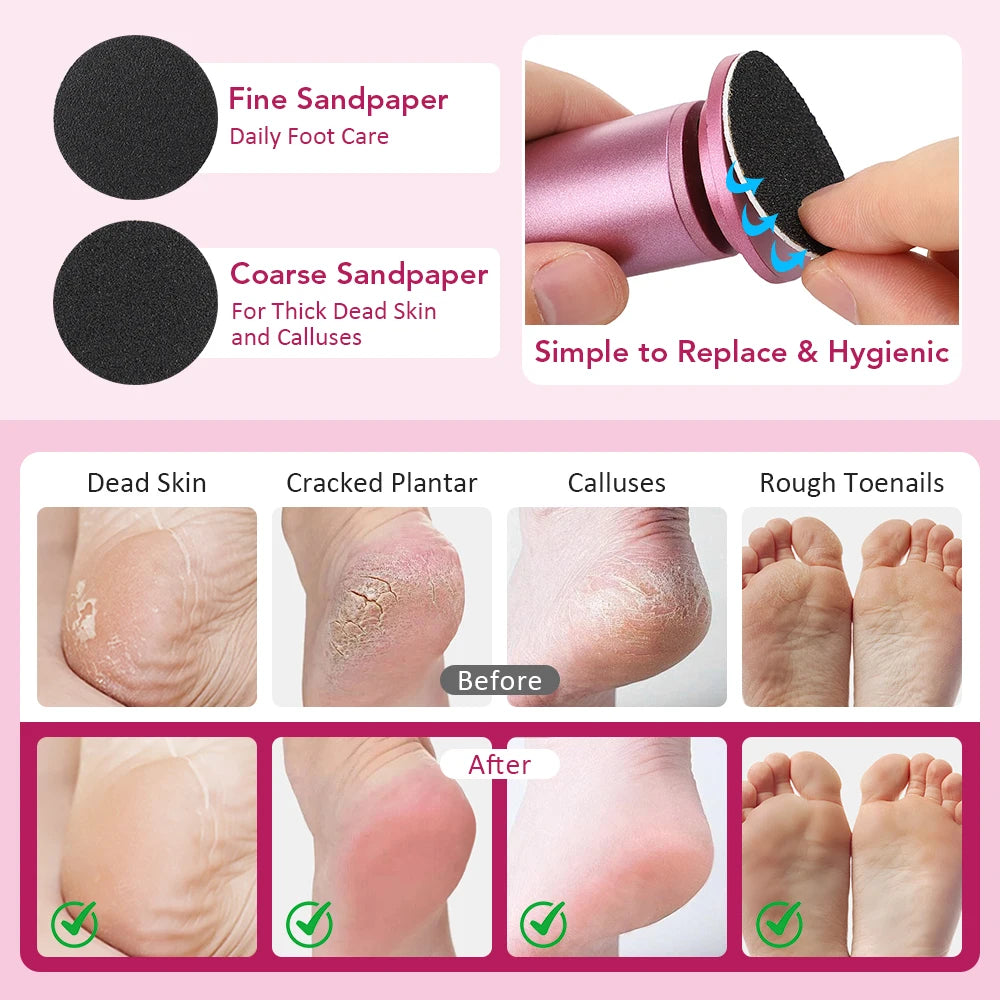 Electric Callus Remover for Smooth Heels and Professional Foot Pedicure - 4