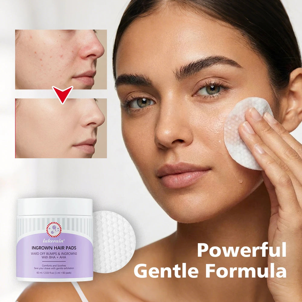 Exfoliating Ingrown Hair Treatment Pads for Razor Bumps and Irritation - 10