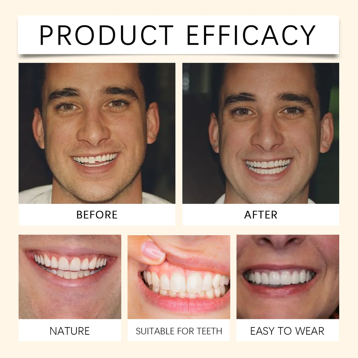 Flexible Silicone Cosmetic Dentures for Missing Teeth and Smile Restoration