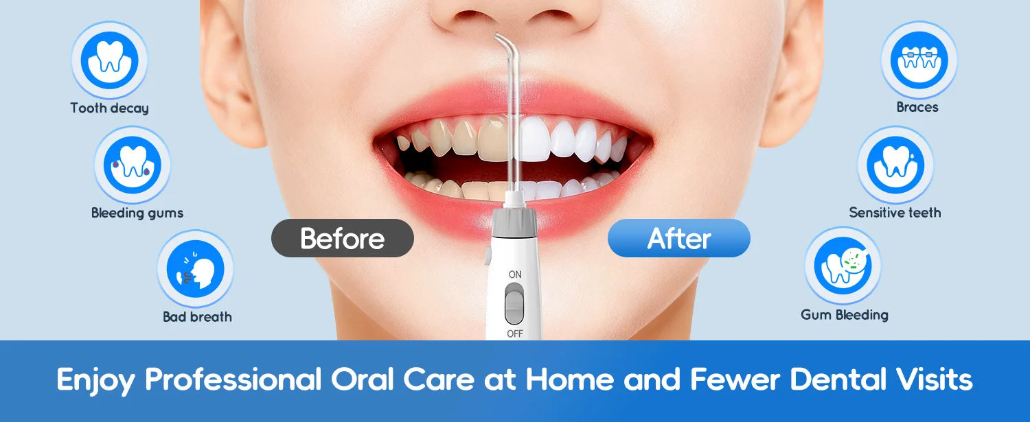 Electric Water Flosser for Teeth with 8 Nozzles and 10 Pressure Settings - 8