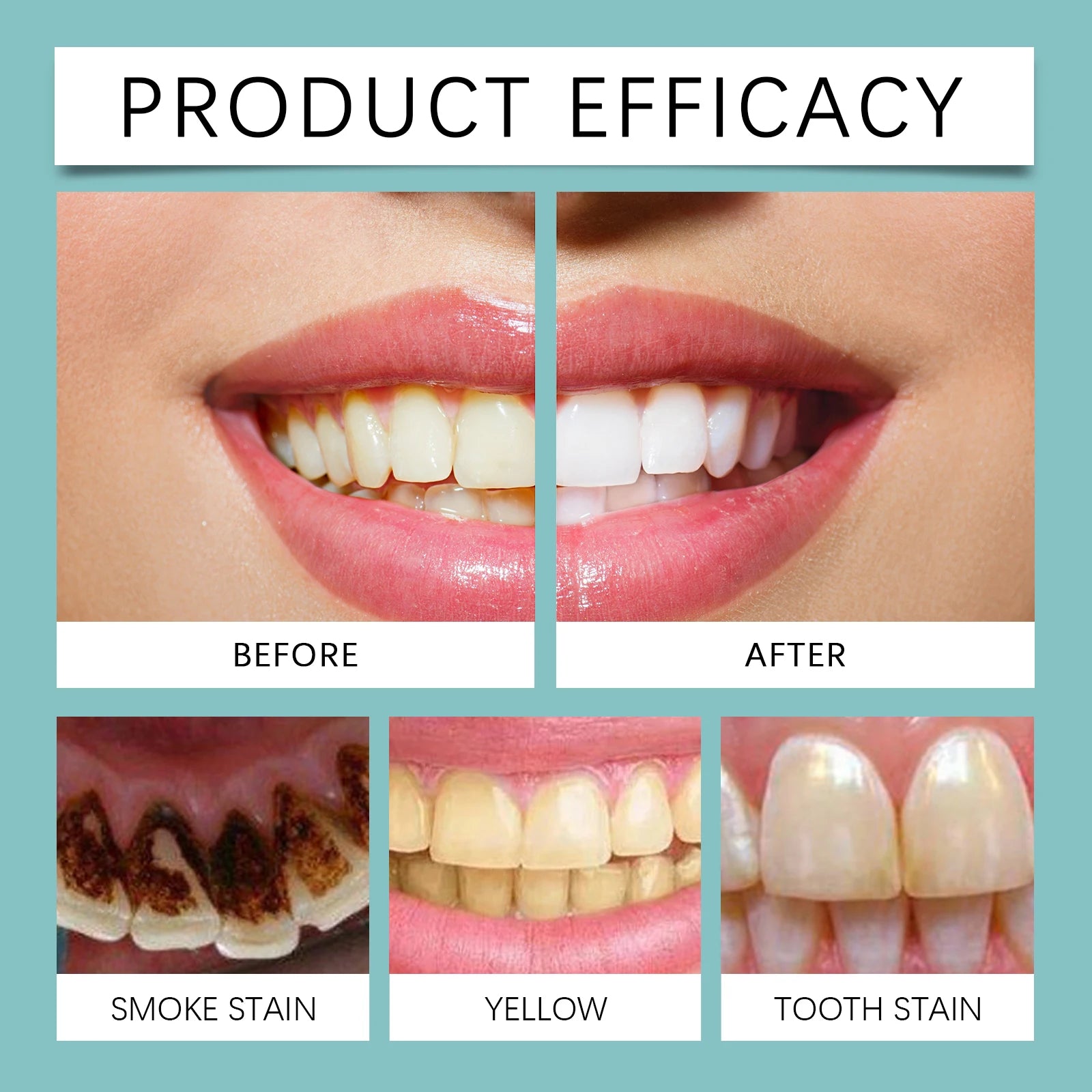 Instant Teeth Whitening Paint for Brighter Smile and Stain Removal - 11