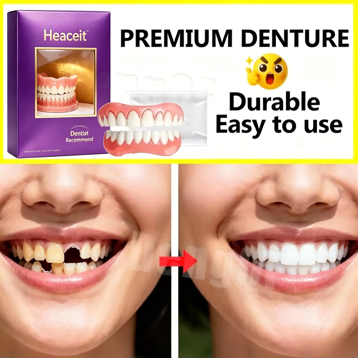 Adjustable Silicone Cosmetic Dentures for a Natural Lifelike Smile