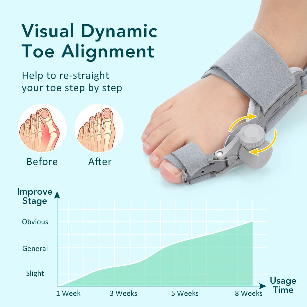Adjustable Orthopedic Bunion Corrector for Painless Toe Alignment - 16