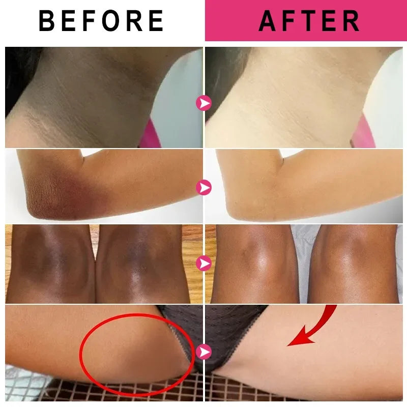 Vitamin C Brightening Cream for Dark Spots Underarms Elbows and Knees