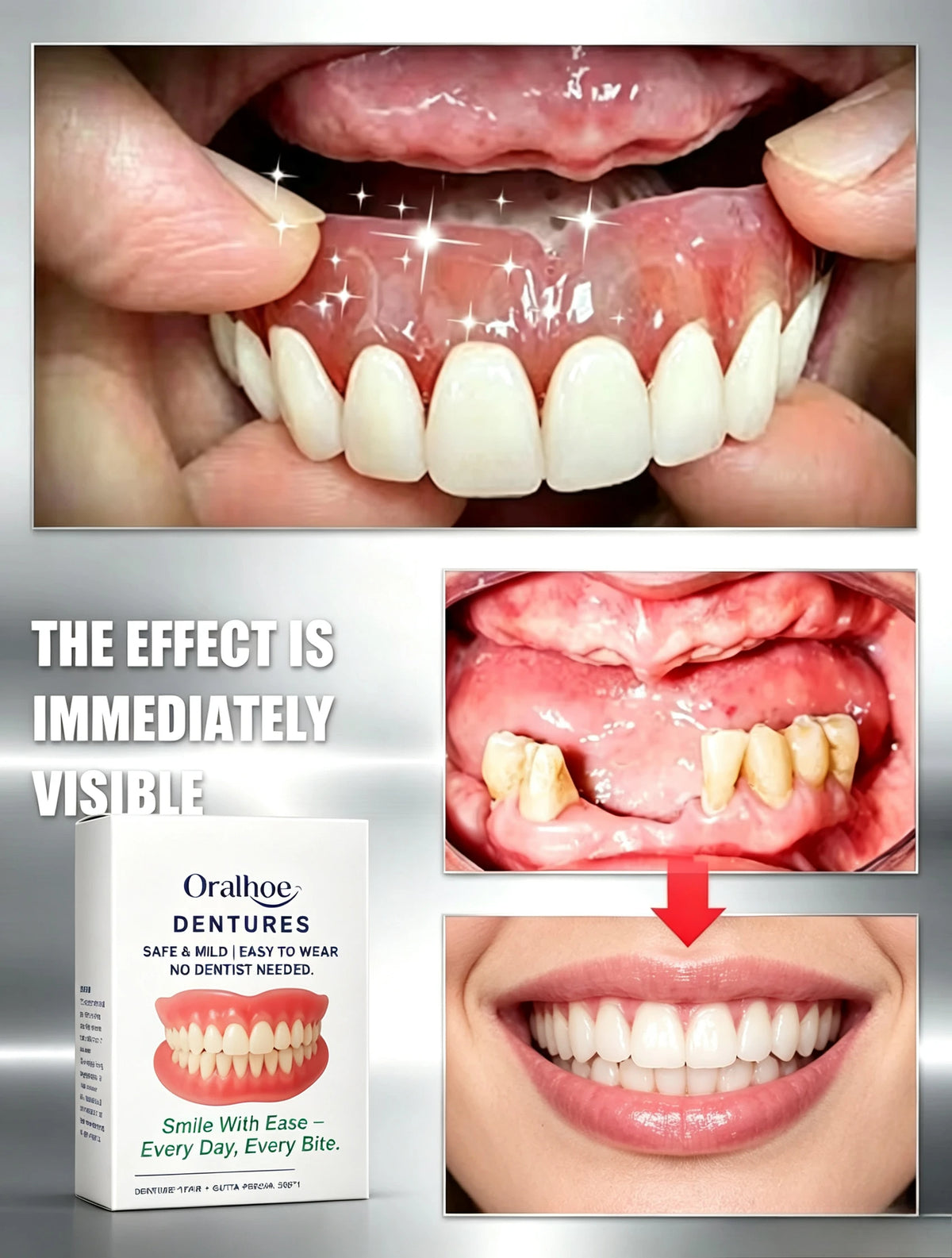 Adjustable Temporary Cosmetic Dentures for a Natural Confident Smile