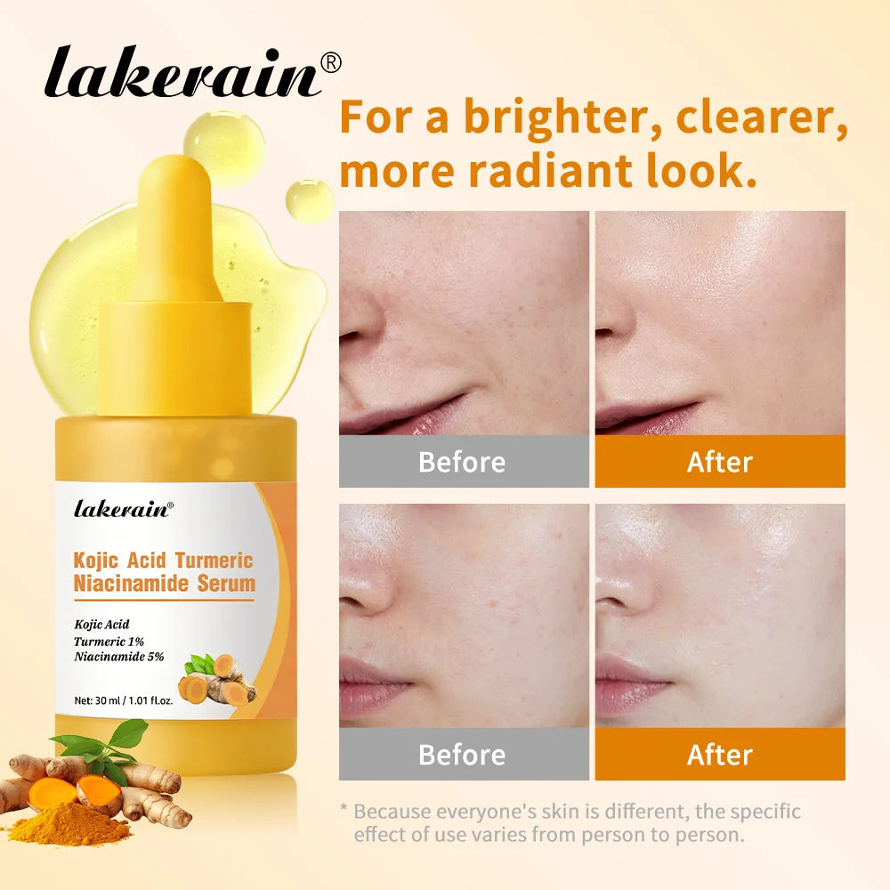 Brightening Kojic Acid and Turmeric Face Serum for Even Skin Tone - 4