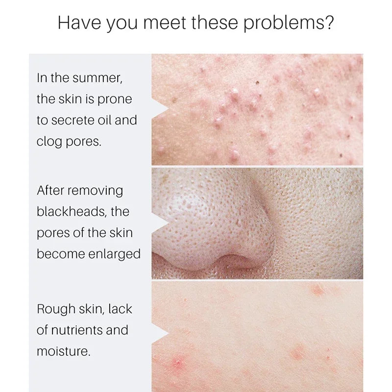 Pore Minimizing Facial Serum for Skin Tightening and Smooth Complexion - 7