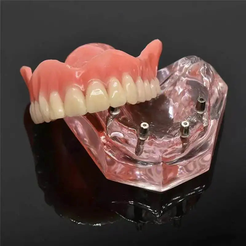 Cosmetic Silicone Teeth Covers for a Natural and Confident Smile