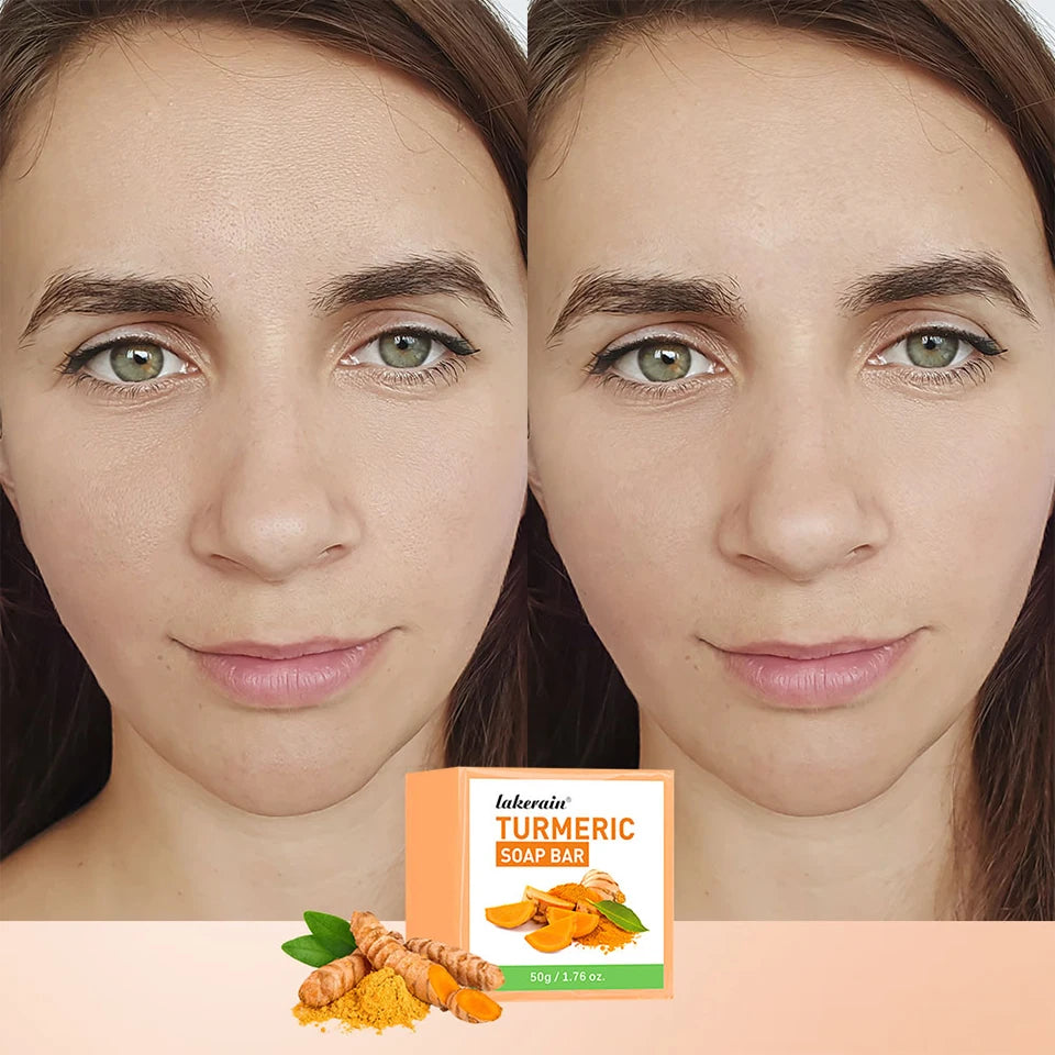 Brightening Turmeric Soap Bar for Face and Body Deep Cleansing