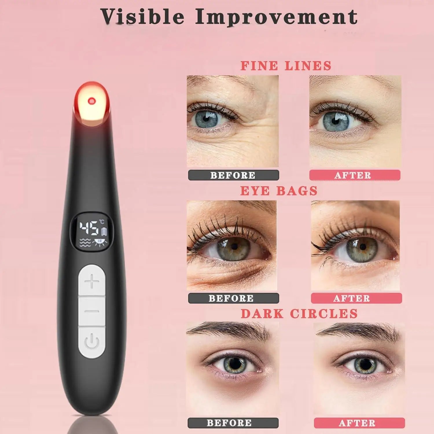 3-in-1 Heated Eye Wand for Dark Circles, Puffiness and Skin Rejuvenation - 2