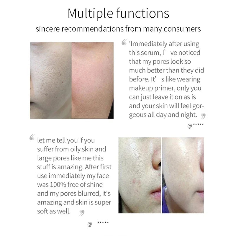 Pore Minimizing Facial Serum for Skin Tightening and Smooth Complexion - 14