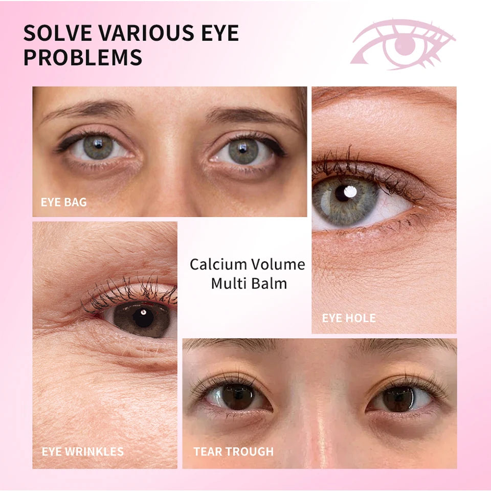 Anti-Wrinkle Calcium Eye Balm Stick for Hydration and Dark Circles - 10