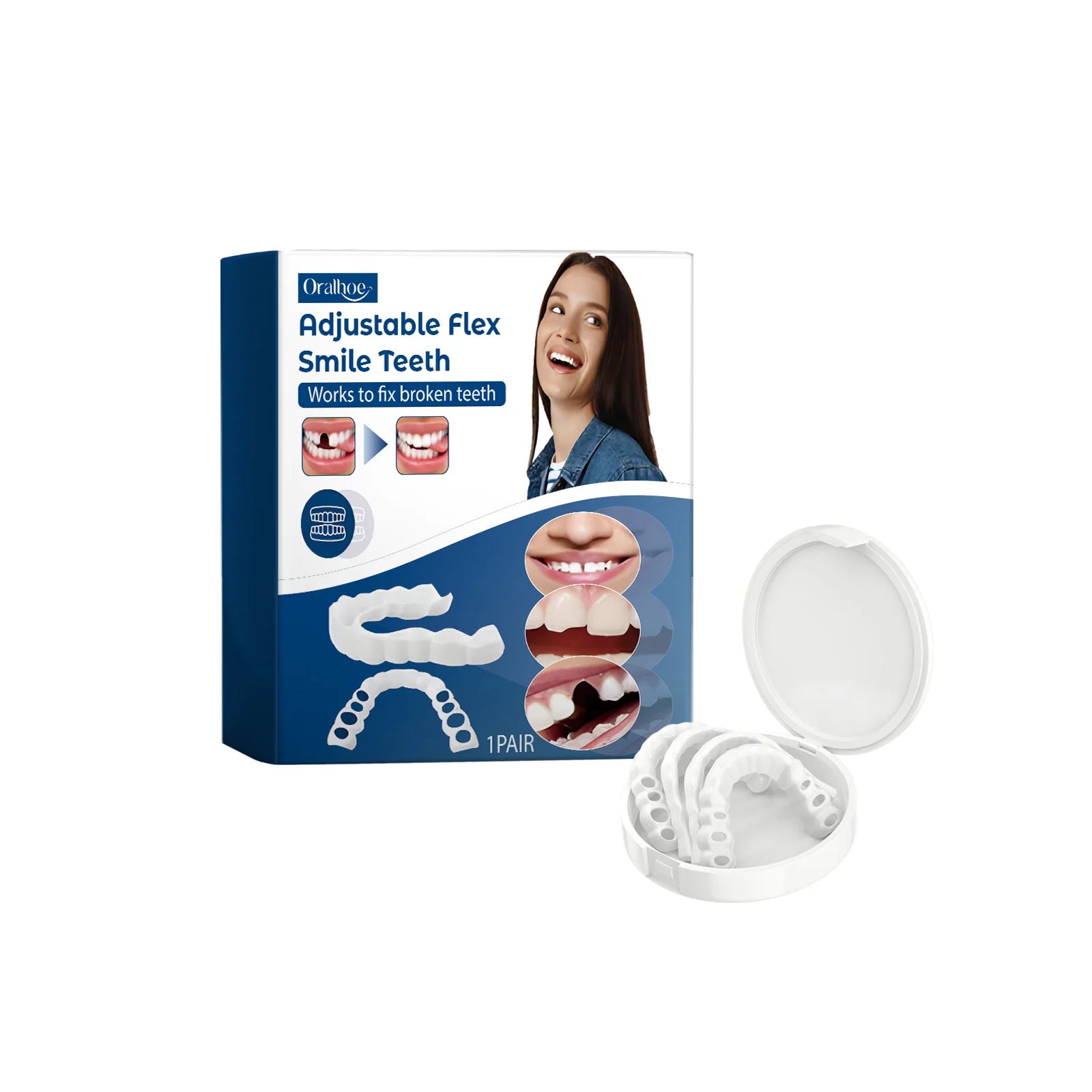 Adjustable Snap-On Silicone Dentures for Instant Smile Repair - 6