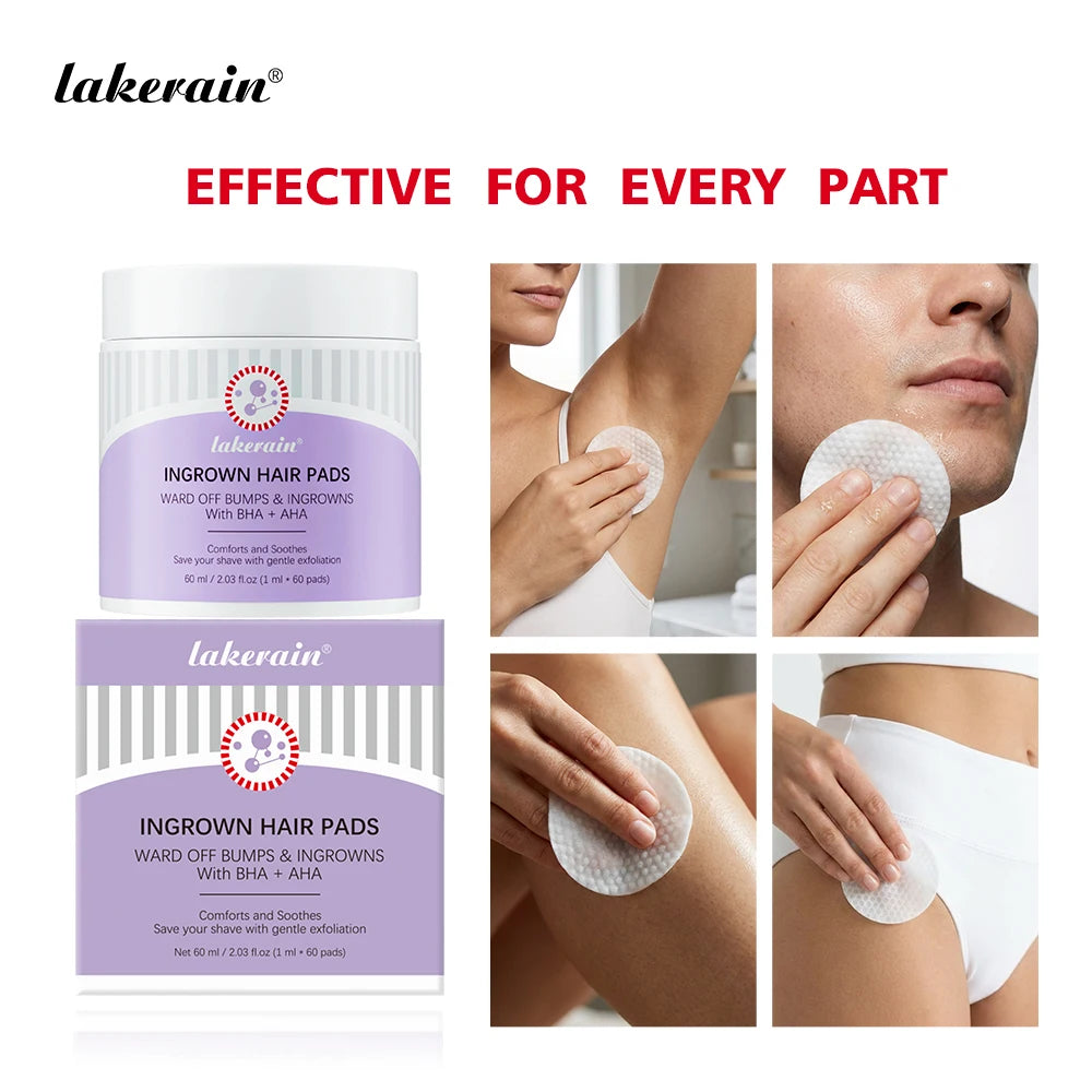 Exfoliating Ingrown Hair Treatment Pads for Razor Bumps and Irritation