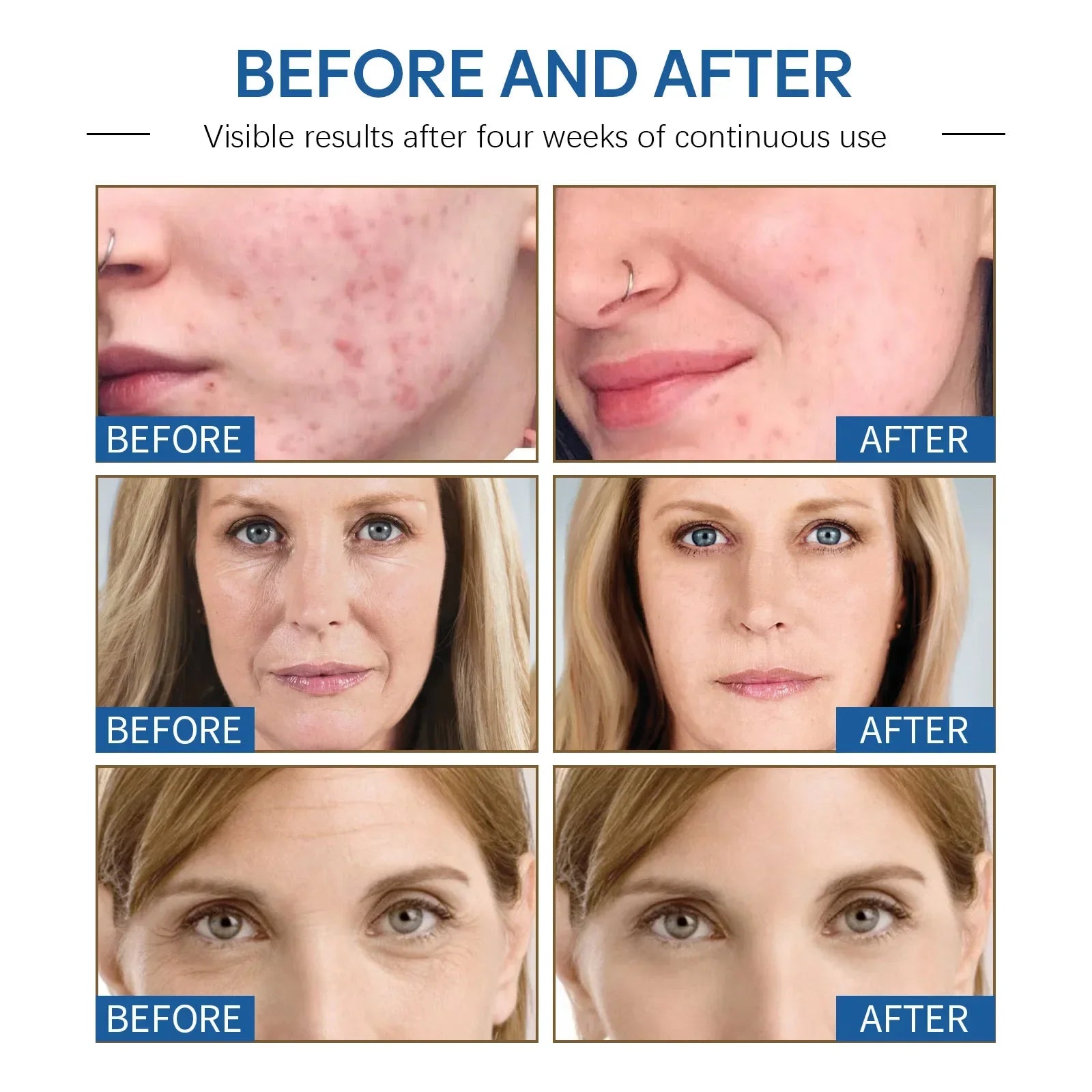 Instant Anti-Wrinkle Face Cream for Firming and Youthful Skin - 14