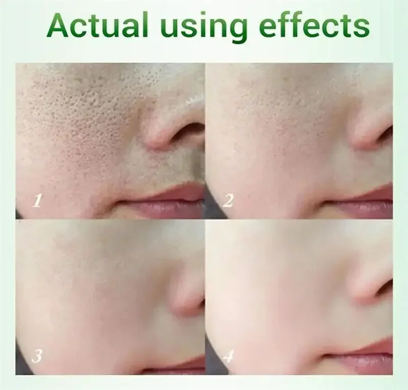Salicylic Acid Pore Refining Cream for Smooth and Clear Skin - 8